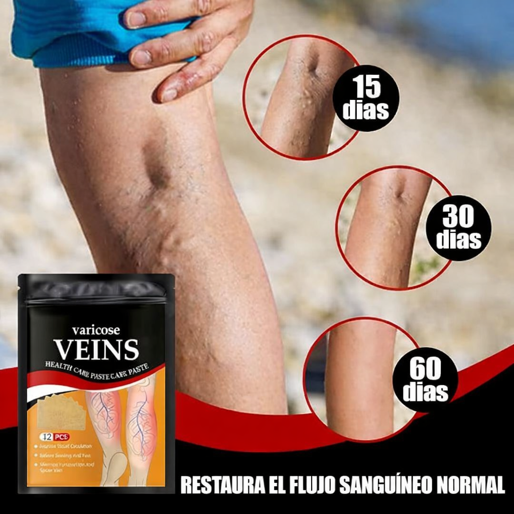 PARCHES PARA VARICES 2x1 - TU SALUD ESTA EN RIESGO, NO ESPERES MAS🚨💡