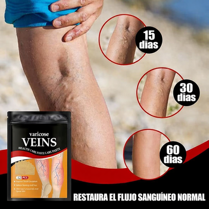 PARCHES PARA VARICES 2x1 - TU SALUD ESTA EN RIESGO, NO ESPERES MAS🚨💡