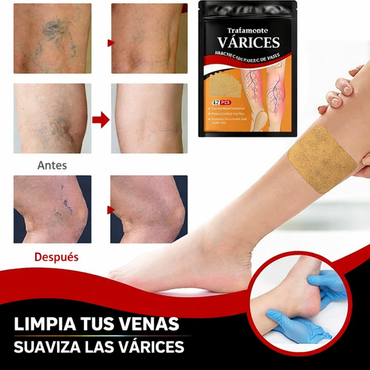 PARCHES PARA VARICES 2x1 - TU SALUD ESTA EN RIESGO, NO ESPERES MAS🚨💡