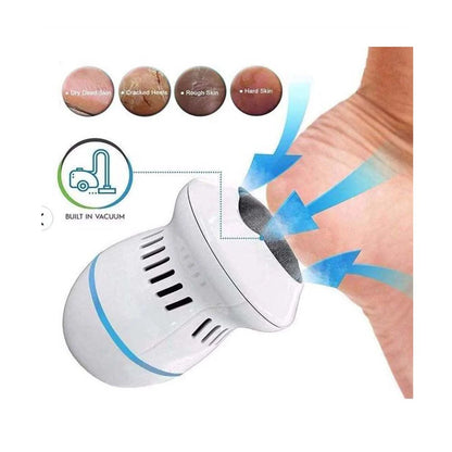 👣✨ Removedor Eléctrico de Callos