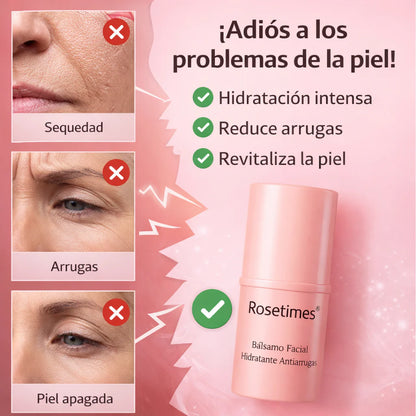 ROSETIMES - Bálsamo Facial Hidratante Antiarrugas 🌺
